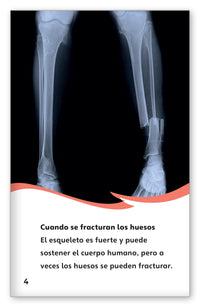 Fracturas from Fábulas y el Mundo Real