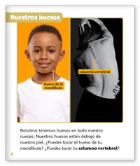 Huesos from Mundo de los Cuentos Mundo Real